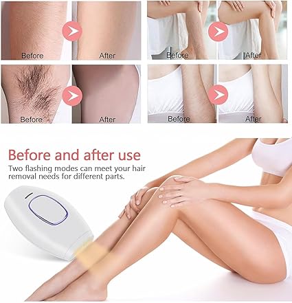 Flashes IPL laser hair Removal