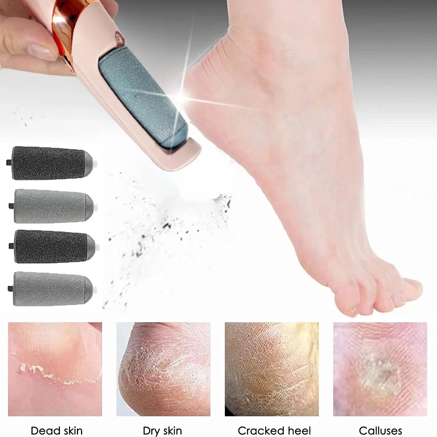 Foot File Callus
